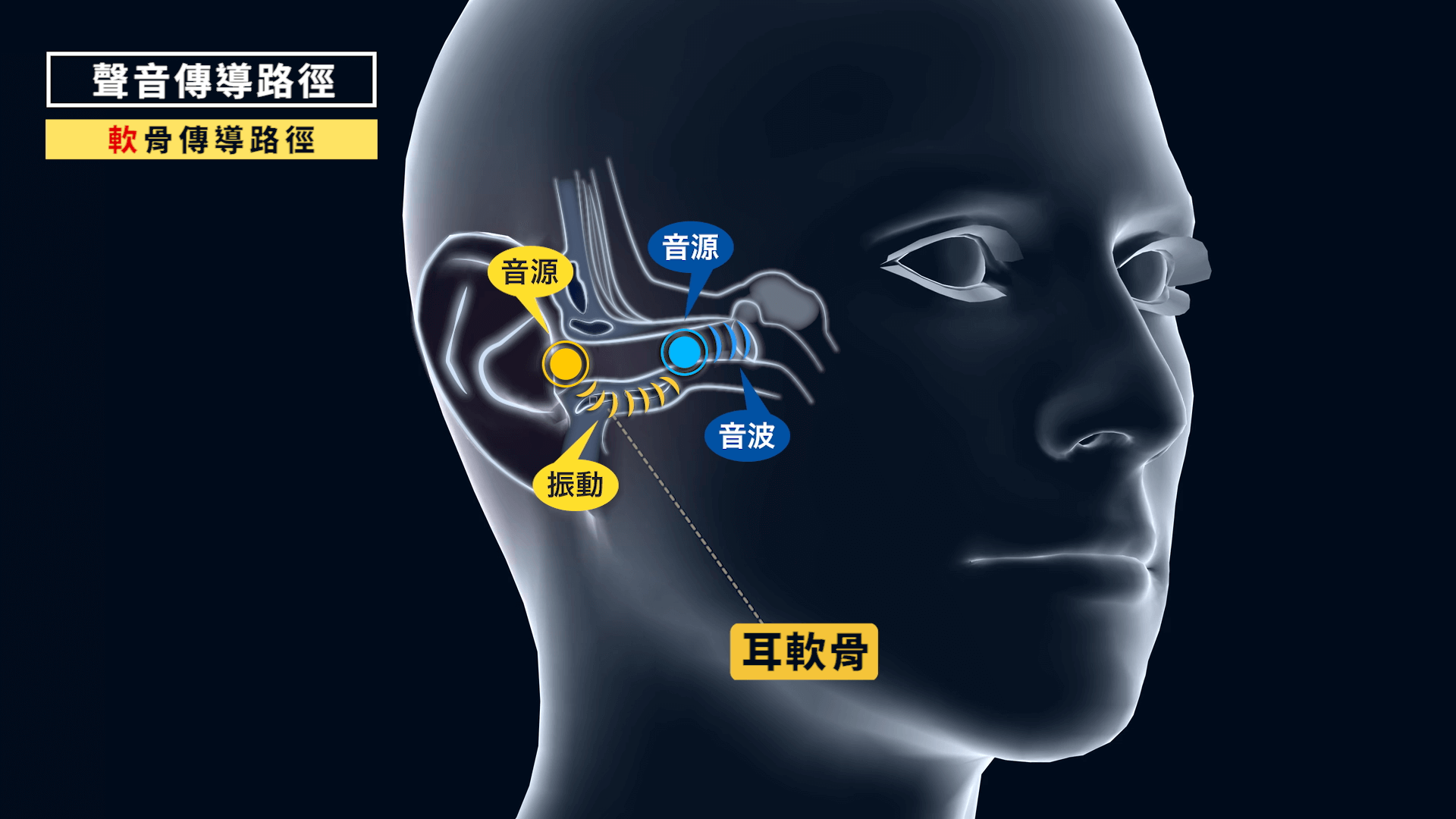 軟骨傳導